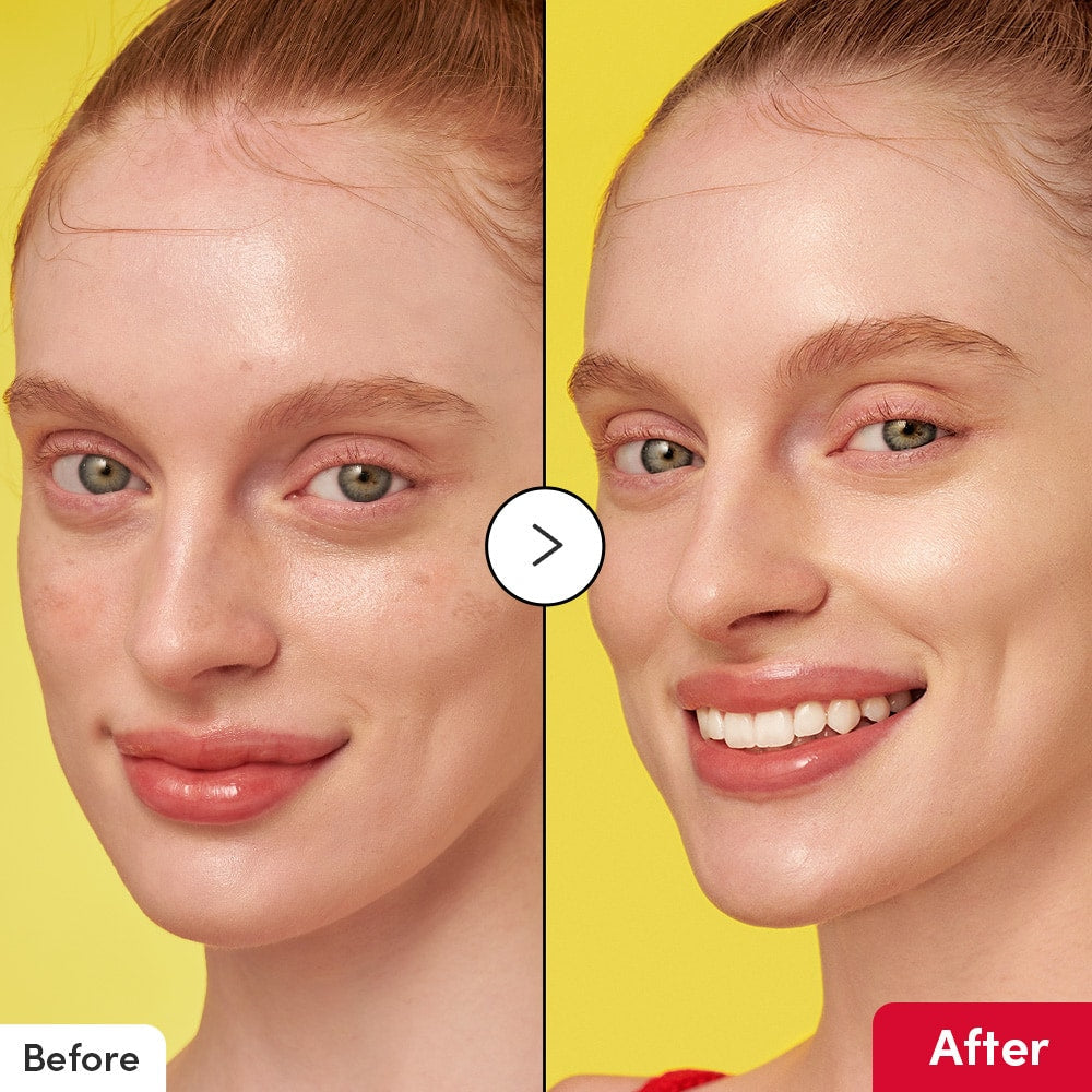 EQQUALBERRY Vitamin illuminating Serum
Brightens and Improves Dark Spots.