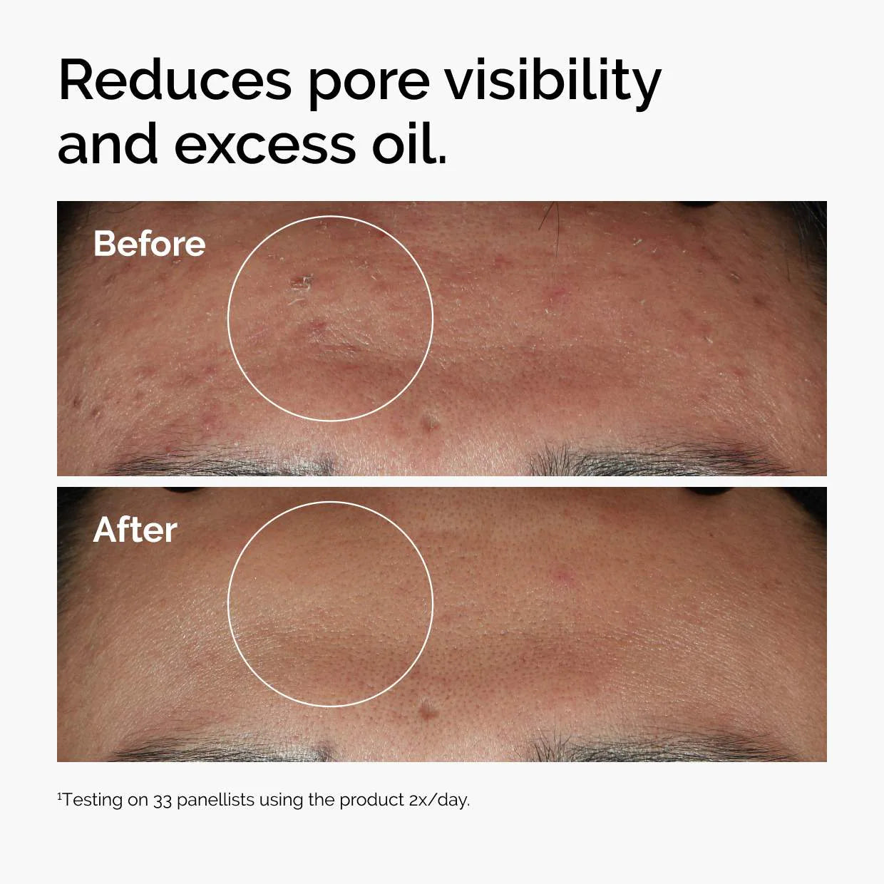 The Ordinary
Niacinamide 10% + Zinc 1% Serum for Oily Skin