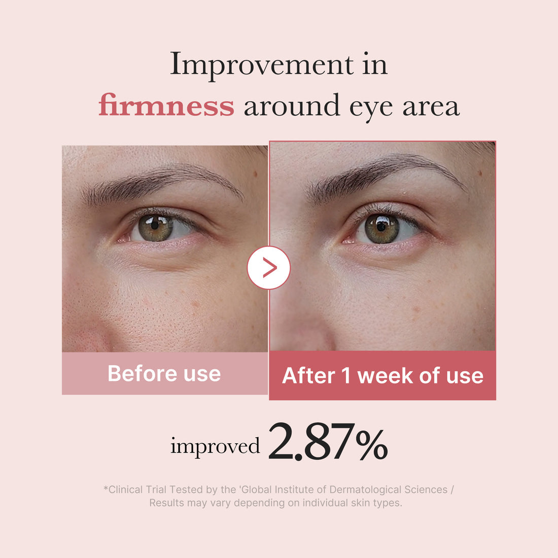 Medicube PDRN Pink Peptide Eye Cream..