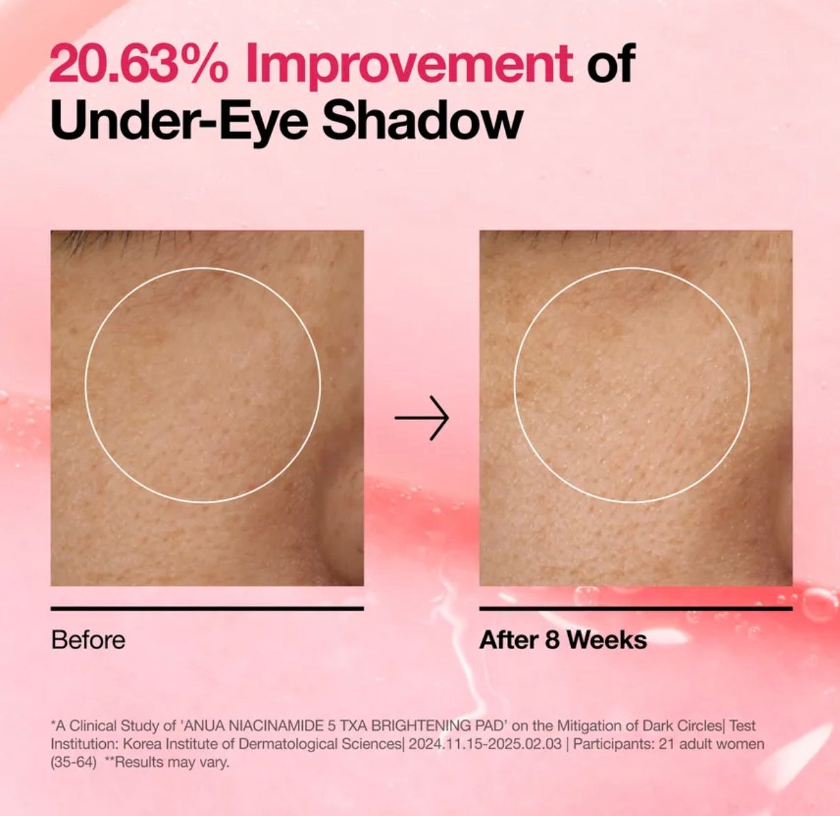 Anua Niacinamide 5 TXA Brightening Pad