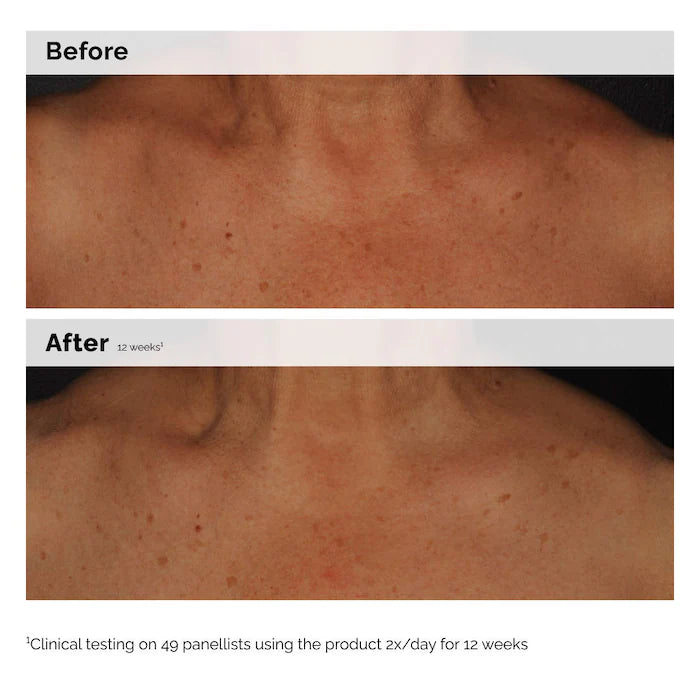 The Ordinary
Niacinamide 5% Face and Body Emulsion for Dark Spots & Uneven Tone