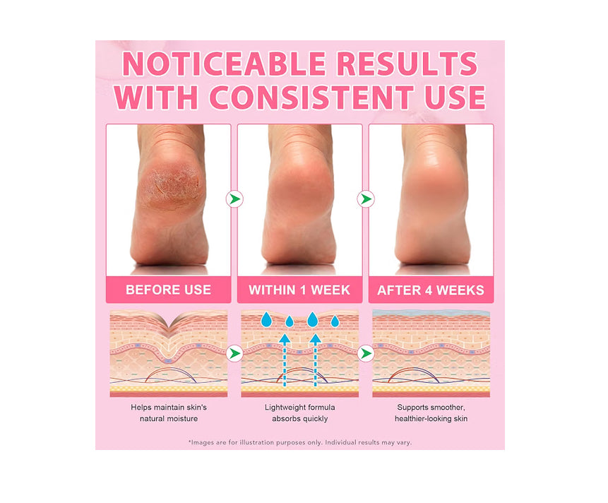 Chenyayun
Urea Cream 60% Plus Salicylic Acid 2% Intensive Foot Repair Balm Stick for Dry Cracked/Chapped Heel/Hands Intensively Moisturization, Callus Removal/Softening/Soothing-Peach Scent.40 G..