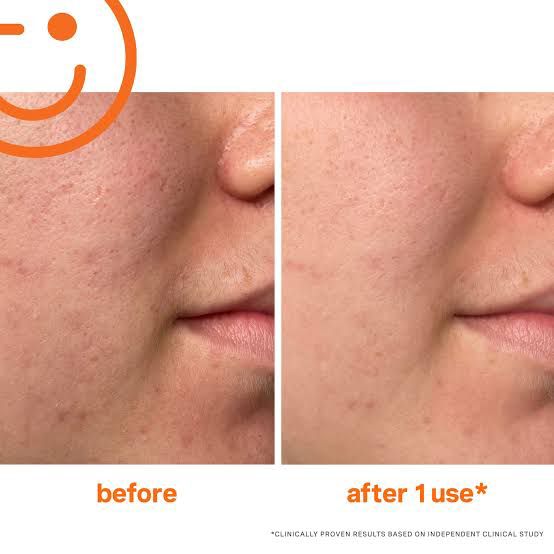 Kate Somerville Exfolikate …