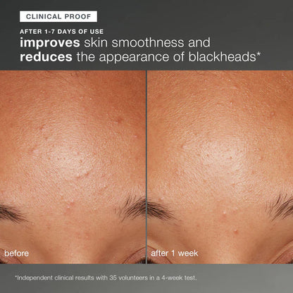 DERMALOGICA Daily Microfoliant 13g