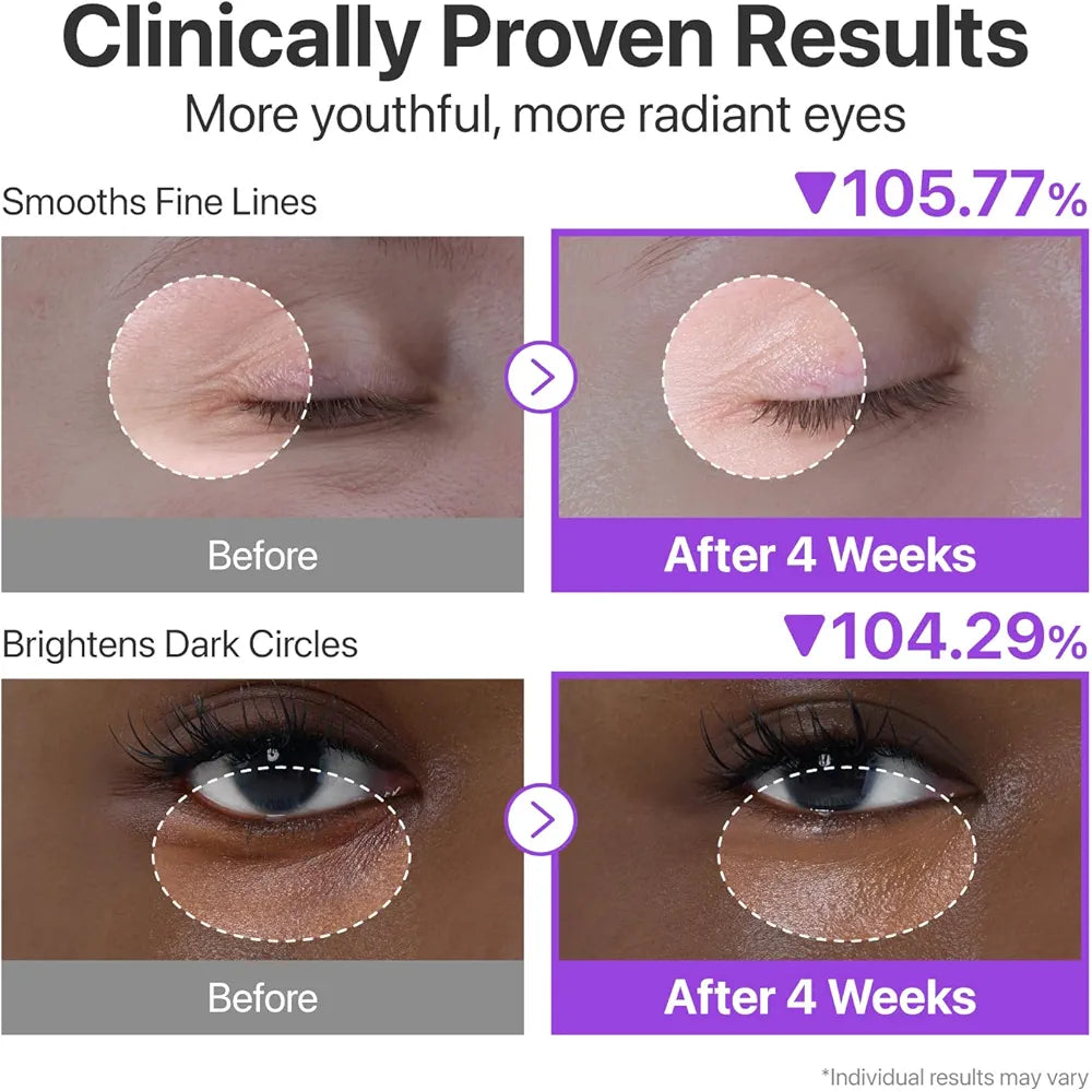Numbuzin No.9 NAD+ Retinol Volumetox Eye cream