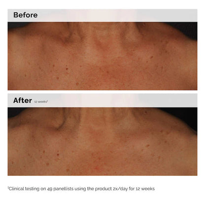 The Ordinary 
Niacinamide 5% Face and Body Emulsion for Dark Spots &amp; Uneven Tone