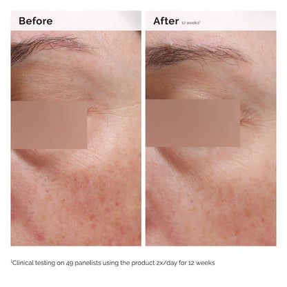 The Ordinary 
Niacinamide 5% Face and Body Emulsion for Dark Spots &amp; Uneven Tone